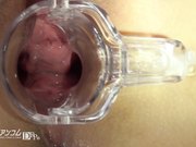 一本道マンコ図鑑 西川ゆい