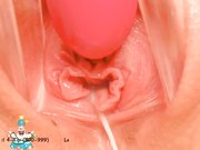 稀缺资源阴道内放置跳蛋高清近景内窥镜看阴道内部变化白浆往外流