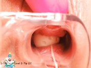 稀缺资源阴道内放置跳蛋高清近景内窥镜看阴道内部变化白浆往外流