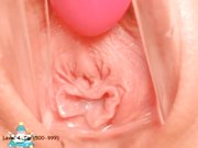 稀缺资源阴道内放置跳蛋高清近景内窥镜看阴道内部变化白浆往外流