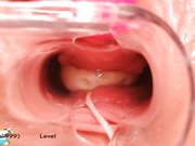 稀缺资源阴道内放置跳蛋高清近景内窥镜看阴道内部变化白浆往外流